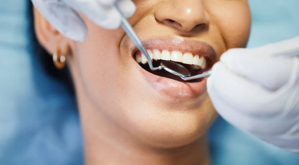 Best Weekend Emergency Dentist in Mcmillin, WA
