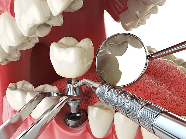 Best Emergency Dental Services for Seniors in Mcmillin, WA
