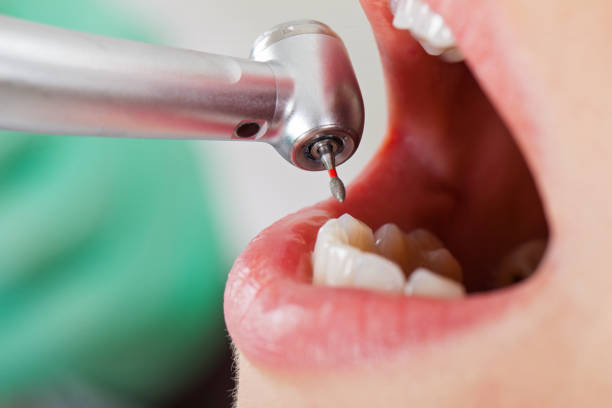 Best Orthodontic Emergency Dentist in Mcmillin, WA